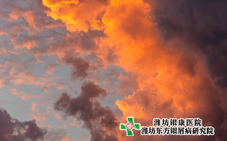 牛皮癬到底會不會傳染?可以吃鈣片嗎?