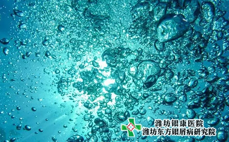 牛皮癬與淋巴有關嗎?反復發作的原因? 牛皮癬與淋巴有關嗎?反復發作的原因?