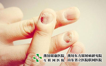 2 (100)手 2 (100)手