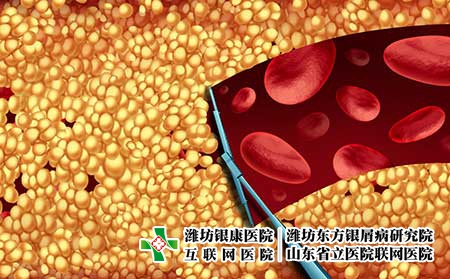 攝圖網_300850448_除膽固醇清潔動脈的醫學,如刮水器,清除堵塞動脈中的斑塊,動脈粥樣硬化疾病醫院治療的象征,打開堵塞的靜脈三維插(企業商用) 攝圖網_300850448_除膽固醇清潔動脈的醫學,如刮水器,清除堵塞動脈中的斑塊,動脈粥樣硬化疾病醫院治療的象征,打開堵塞的靜脈三維插(企業商用)