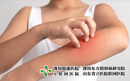 2 (262)瘙癢 2 (262)瘙癢