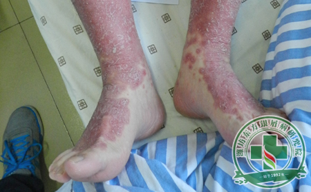 二月二龍抬頭的養生保健方法