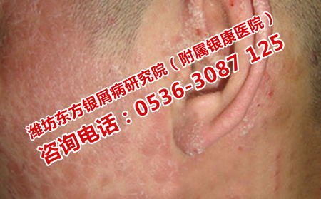 選擇濰坊銀康醫院怎么樣