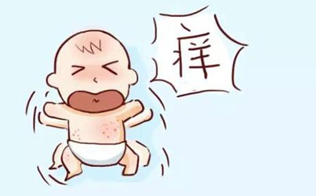 銀屑病應該怎么治療好