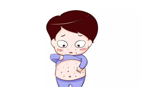 什么癥狀是銀屑病