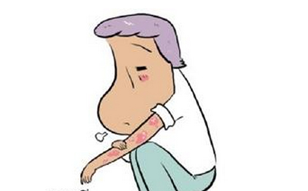 關(guān)節(jié)型銀屑病的癥狀有什么