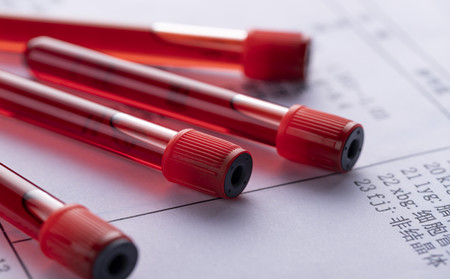 治療關節(jié)型銀屑病,濰坊治療關節(jié)型銀屑病