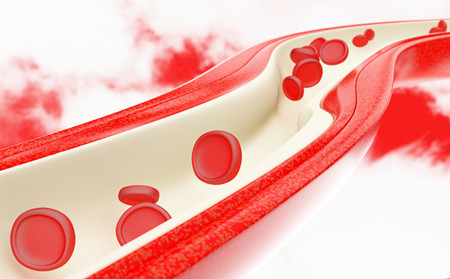 兒童銀屑病治療,兒童輕度銀屑病治療