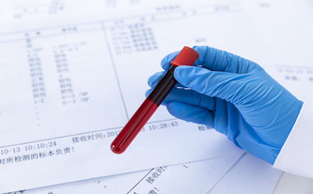 銀屑病夏季調(diào)養(yǎng),夏季怎樣調(diào)養(yǎng)銀屑病