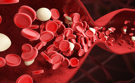 紅皮型牛皮癬危害,紅皮型牛皮癬有什么危害