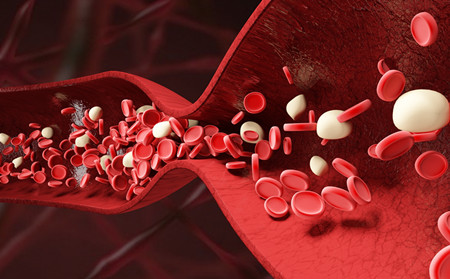 濰坊銀康醫院,濰坊選擇治銀屑病醫院