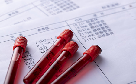 怎樣防治頭部牛皮癬,防治頭部牛皮癬方法