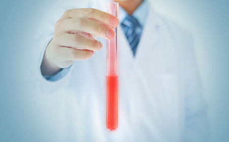 尋常型牛皮癬常識,尋常型牛皮癬流膿