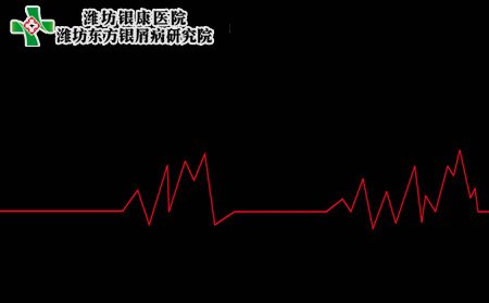 銀屑病傳染嗎,銀屑病會(huì)不會(huì)傳染人