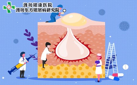 銀屑病病因,冬季銀屑病發(fā)病原因