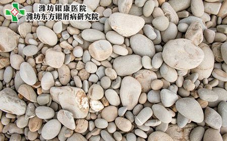 預(yù)防銀屑病的方法有哪些?