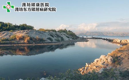 發生銀屑病的病因是什么?