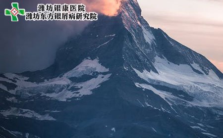 銀屑病會傳染嗎?需要多久?
